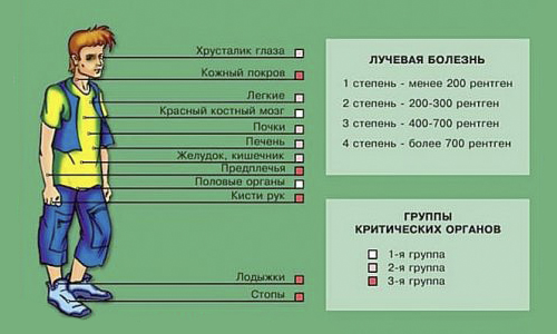 Лучевая болезнь в результате излучения